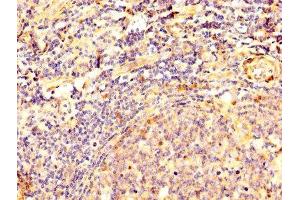 IHC image of ABIN7149787 diluted at 1:500 and staining in paraffin-embedded human tonsil tissue performed on a Leica BondTM system. (Desmoglein 3 抗体  (AA 70-615))