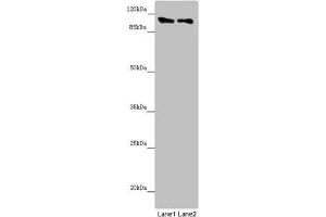 Western blot All lanes: DDX11 antibody at 8. (DDX11 抗体  (AA 1-220))