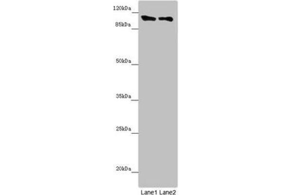 DDX11 antibody  (AA 1-220)