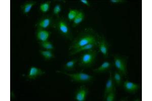 Immunofluorescence staining of Hela cells with ABIN7157599 at 1:200, counter-stained with DAPI. (KIF15 抗体  (AA 1-129))