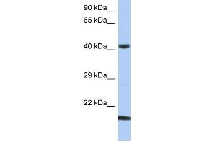 WB Suggested Anti-SEC14L4 Antibody Titration: 0. (SEC14L4 抗体  (N-Term))