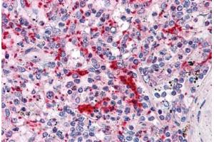 Human Spleen: Formalin-Fixed, Paraffin-Embedded (FFPE) (TLN1 抗体  (AA 1052-1150))