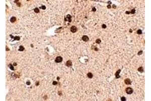 Immunohistochemistry (IHC) image for anti-Regulating Synaptic Membrane Exocytosis 3 (RIMS3) (N-Term) antibody (ABIN1031542) (RIMS3 抗体  (N-Term))