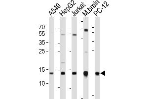 Western blot analysis of lysates from A549, HepG2, Jurkat cell line, mouse brain tissue lysate, rat PC-12 cell line (from left to right), using ATP5D Antibody (C-term) (ABIN6242954 and ABIN6577658). (ATP5F1D 抗体  (C-Term))