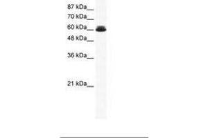 Image no. 1 for anti-DEAD (Asp-Glu-Ala-Asp) Box Polypeptide 27 (DDX27) (AA 118-167) antibody (ABIN202920) (DDX27 抗体  (AA 118-167))