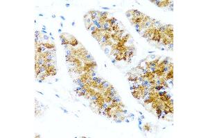 Immunohistochemistry of paraffin-embedded human stomach using SIRT1 antibody at dilution of 1:100 (40x lens). (SIRT1 抗体  (C-Term))