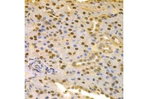 Immunohistochemistry of paraffin-embedded rat kidney using COPS5 antibody. (COPS5 抗体  (AA 1-334))