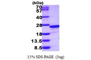 SDS-PAGE (SDS) image for Transgelin 2 (TAGLN2) (AA 13-199) protein (His tag) (ABIN667368) (TAGLN2 Protein (AA 13-199) (His tag))
