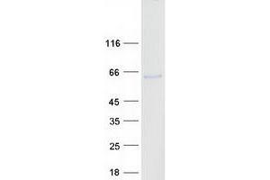 Western Blotting (WB) image for Patatin-Like phospholipase Domain Containing 3 (PNPLA3) protein (Myc-DYKDDDDK Tag) (ABIN2729263)
