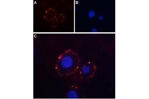 Immunocytochemistry (ICC) image for anti-Purinergic Receptor P2x, Ligand-Gated Ion Channel, 3 (P2RX3) (AA 65-79), (Extracellular) antibody (ABIN7043422)