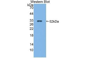 Western Blotting (WB) image for anti-Cytochrome P450, Family 27, Subfamily B, Polypeptide 1 (CYP27B1) (AA 251-500) antibody (ABIN1862408) (CYP27B1 抗体  (AA 251-500))