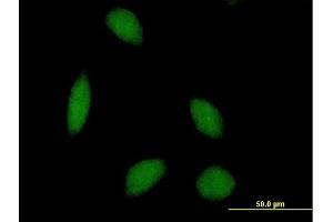 Immunofluorescence of purified MaxPab antibody to ALS2CR8 on HeLa cell. (Calcium Responsive Transcription Factor (CARF) (AA 1-718) 抗体)
