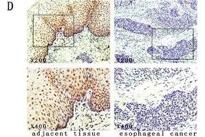 The expression and methylation status of IGFBPL1 in human esophageal dysplasia and ESCC. (IGFBPL1 抗体  (AA 201-278))