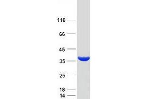 Western Blotting (WB) image for Geranylgeranyl Diphosphate Synthase 1 (GGPS1) (Transcript Variant 2) protein (Myc-DYKDDDDK Tag) (ABIN2721864)
