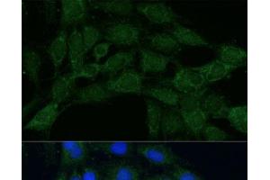 Immunofluorescence (IF) image for anti-Methylenetetrahydrofolate Dehydrogenase (NADP+ Dependent) 2, Methenyltetrahydrofolate Cyclohydrolase (MTHFD2) antibody (ABIN7255295)