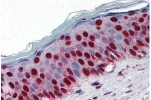 Human Skin (formalin-fixed, paraffin-embedded) stained with NPM1 antibody ABIN364324 at 5 ug/ml followed by biotinylated anti-mouse IgG secondary antibody ABIN481714, alkaline phosphatase-streptavidin and chromogen. (NPM1 抗体  (AA 81-294))