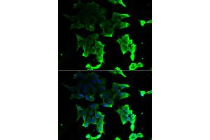 Immunofluorescence analysis of HeLa cells using TANK antibody (ABIN5974093). (TANK 抗体)