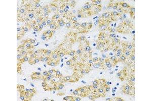 Immunohistochemistry of paraffin-embedded Human liver using SLC16A4 Polyclonal Antibody at dilution of 1:100 (40x lens). (SLC16A4 抗体)