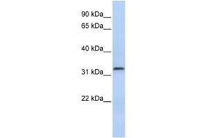 WB Suggested Anti-LACTB2 Antibody Titration: 0. (LACTB2 抗体  (Middle Region))