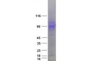 Western Blotting (WB) image for Solute Carrier Family 7 (Cationic Amino Acid Transporter, Y+ System), Member 2 (SLC7A2) (Transcript Variant 2) protein (Myc-DYKDDDDK Tag) (ABIN2732179)