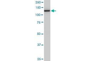 Western Blotting (WB) image for anti-Cullin-Associated and Neddylation-Dissociated 1 (CAND1) (AA 1-100) antibody (ABIN527716)