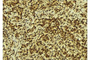 Immunohistochemistry (IHC) image for anti-Cysteine and Glycine-Rich Protein 1 (CSRP1) (Internal Region) antibody (ABIN6258036)