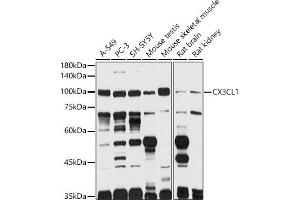 Western blot analysis of extracts of various cell lines, using CX3CL1 antibody (ABIN6129035, ABIN6139265, ABIN6139266 and ABIN6218481) at 1:1000 dilution. (CX3CL1 抗体  (AA 365-397))