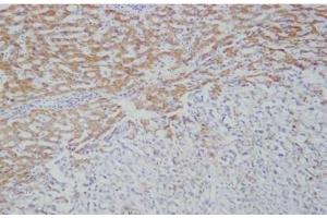 IHC: Immunohistochemical analysis of Ficolin-2 in frozen human liver tissue using mAb GN5 (Ficolin 2 抗体)