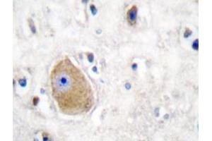 Immunohistochemistry analyzes of HADH2 antibody in paraffin-embedded human brain tissue. (HSD17B10 抗体)