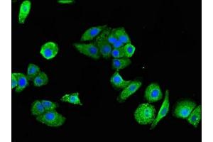 Immunofluorescent analysis of HepG2 cells using ABIN7162439 at dilution of 1:100 and Alexa Fluor 488-congugated AffiniPure Goat Anti-Rabbit IgG(H+L) (P2RX1 抗体  (AA 54-175))