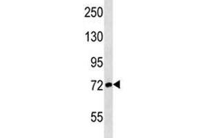 Western Blotting (WB) image for anti-ATG7 Autophagy Related 7 (ATG7) (AA 22-51) antibody (ABIN3030039)