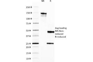 SDS-PAGE (SDS) image for anti-Ferritin, Light Polypeptide (FTL) (AA 38-165) antibody (ABIN6939459)