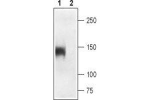 Western blot analysis of rat skeletal muscle: - 1. (CACNA1S 抗体  (2nd Extracellular Loop, Domain 4))