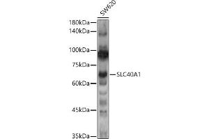 Western Blotting (WB) image for anti-Solute Carrier Family 40 (Iron-Regulated Transporter), Member 1 (SLC40A1) (AA 200-300) antibody (ABIN7270462)