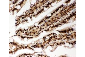 IHC-P testing of rat intestine tissue (Lamin A/C 抗体  (AA 481-646))