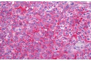 Anti-B2M antibody IHC staining of human tonsil.