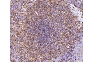 IHC analysis of CD135/FLT3 using anti-CD135/FLT3 antibody (ABIN7602257). (FLT3 抗体  (AA 66-993))