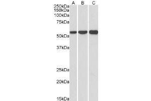 ABIN5539671 (1µg/ml) staining of HeLa (A), HepG2 (B) and K562 (C) lysates (35µg protein in RIPA buffer). (HMGCS1 抗体  (AA 321-332))