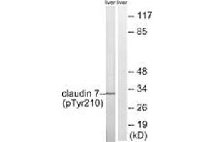 Western blot analysis of extracts from rat liver, using Claudin 7 (Phospho-Tyr210) Antibody. (Claudin 7 抗体  (pTyr210))