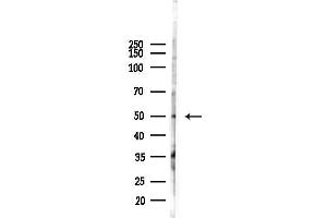 Western blot analysis of lysates from HUVEC cells(heat-shock 45 min treatment), using FOX Antibody at 1/1000 dilution.