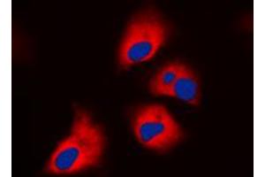 Immunofluorescent analysis of S6K1 (pT444) staining in HepG2 cells. (RPS6KB1 抗体  (C-Term, pSer444))