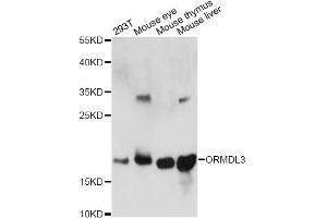 Western blot analysis of extracts of various cell lines, using ORMDL3 antibody. (ORMDL3 抗体)