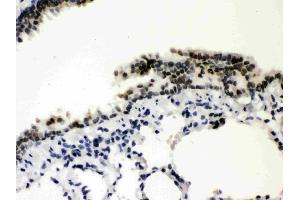IHC analysis of SP3 using anti-SP3 antibody (ABIN3043350).