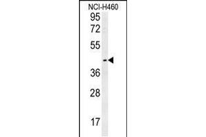 Western blot analysis in NCI-H460 cell line lysates (35ug/lane). (LAPTM5 抗体  (N-Term))