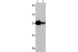 Western Blotting (WB) image for anti-Chromobox Homolog 2 (CBX2) antibody (ABIN2427917) (CBX2 抗体)
