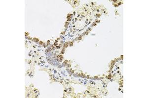 Immunohistochemistry (IHC) image for anti-Regenerating Islet-Derived 3 alpha (REG3A) (AA 27-175) antibody (ABIN6146855)