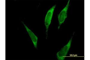 Immunofluorescence of purified MaxPab antibody to FARSLA on HeLa cell. (Phenylalanyl-tRNA Synthetase, alpha Subunit (FARSA) (AA 1-508) 抗体)