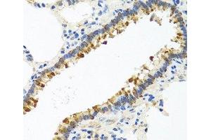 Immunohistochemistry of paraffin-embedded Rat lung using CST4 Polyclonal Antibody at dilution of 1:100 (40x lens). (CST4 抗体)