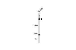 Anti-SYNE2 Antibody (N-Term) at 1:1000 dilution + Human liver lysate Lysates/proteins at 20 μg per lane. (SYNE2 抗体  (AA 1843-1877))