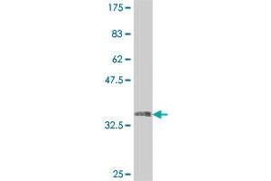 Western Blot detection against Immunogen (35. (USP49 抗体  (AA 275-362))
